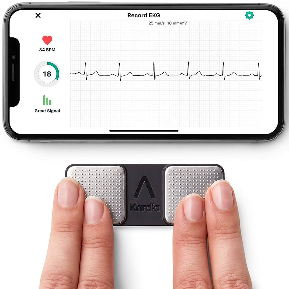 My Review of AliveCor Kardia Mobile EKG for Heart Palpitations